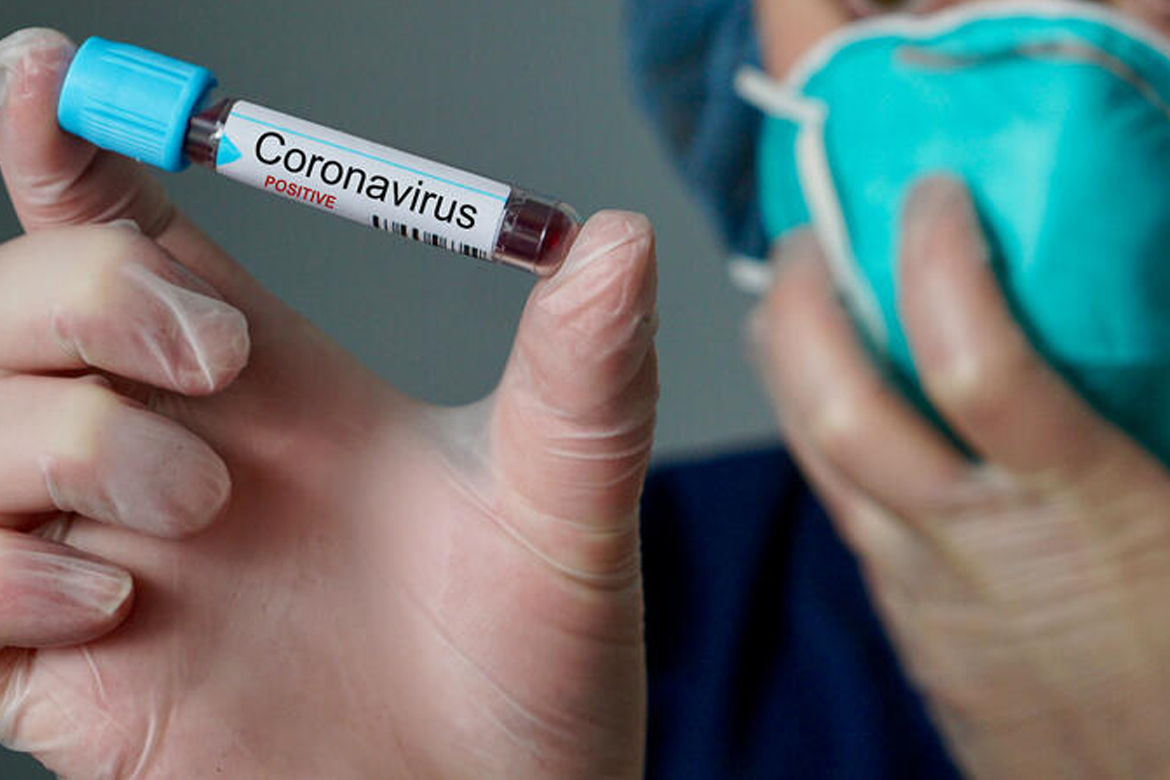 Coronavírus: quem está mais suscetível a ele e aos sintomas graves