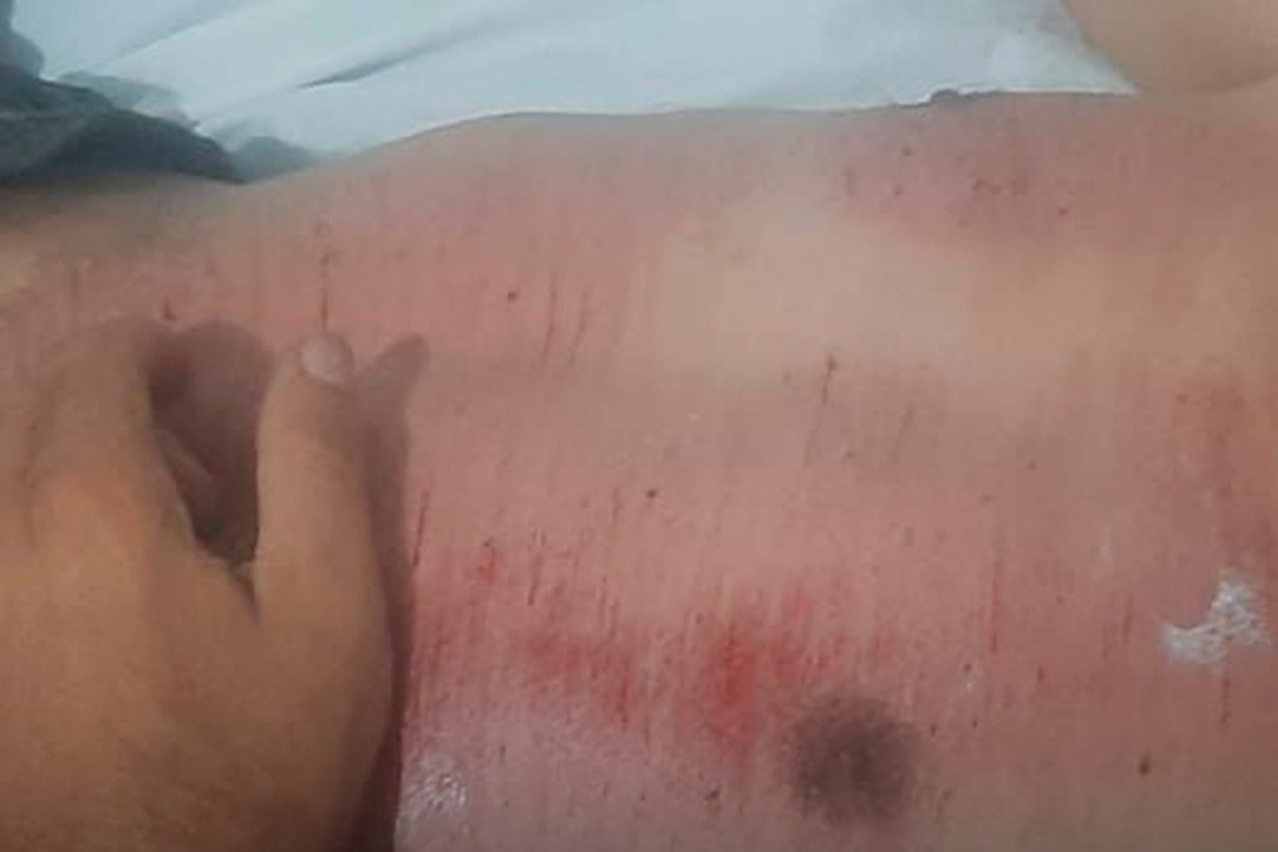 Homem sobrevive após carro passar por cima de seu corpo em Ipaporanga