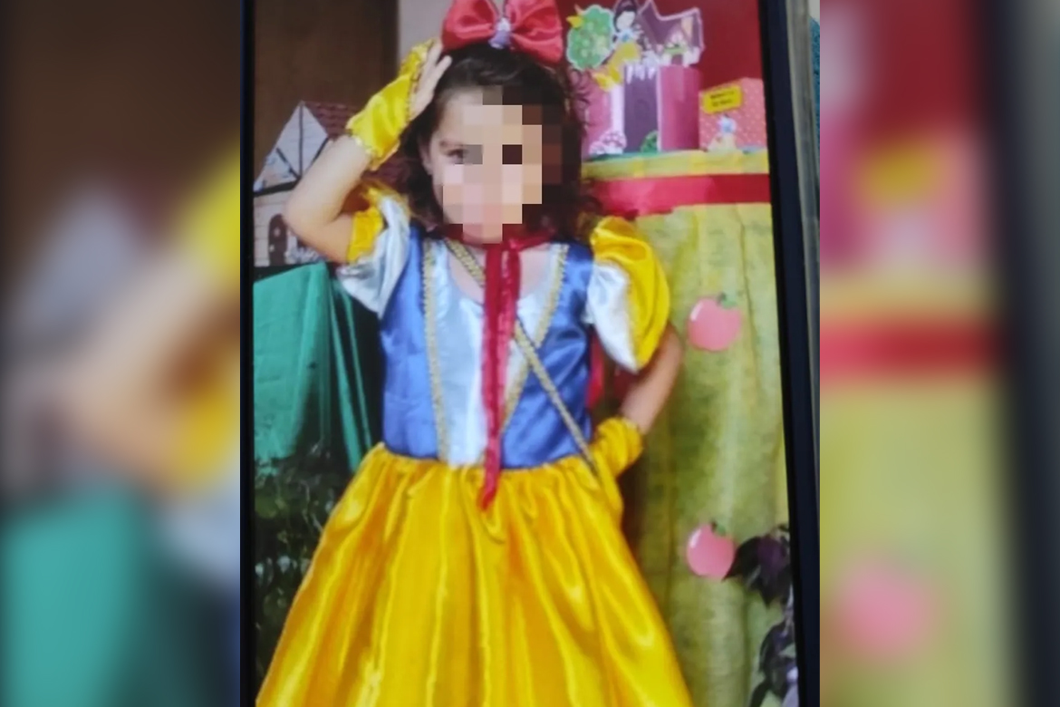 Criança de 3 anos sofre graves queimaduras após cair em panela com gordura quente em Independência-CE