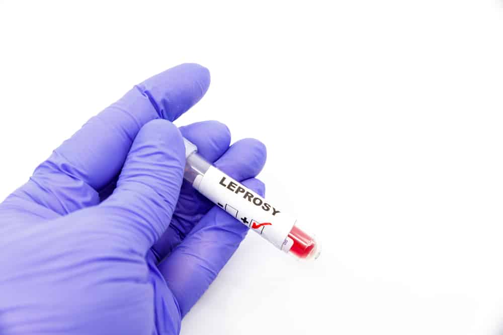 Quais são as doenças mais antigas da humanidade ainda sem cura?