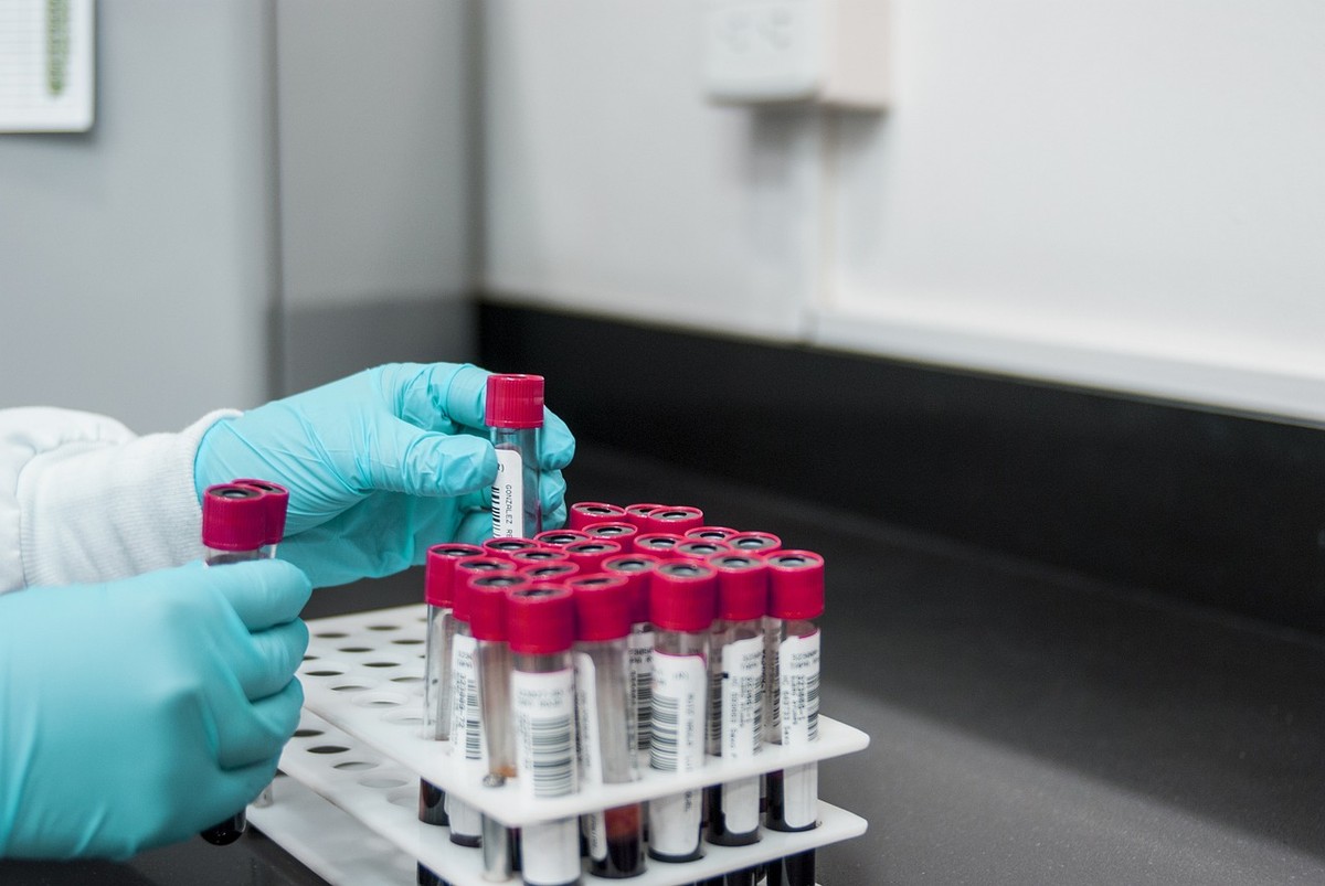 Entenda em que pé estão as investigações do caso dos órgãos infectados com HIV | Rio de Janeiro