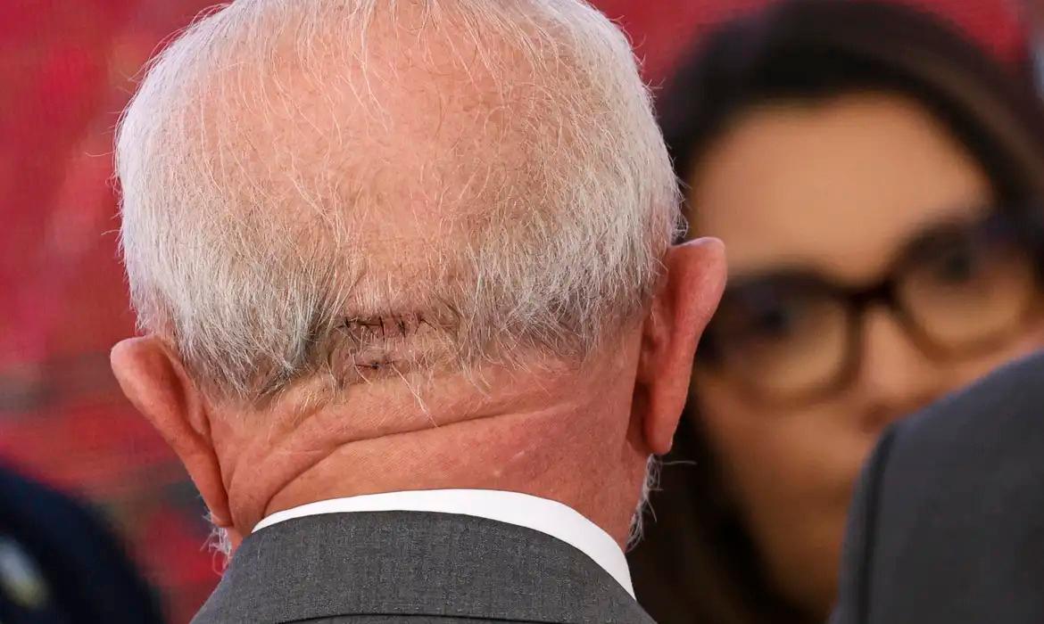 Lula recebe liberação médica para viajar de avião após passar por novos exames neste domingo (10) - PontoPoder
