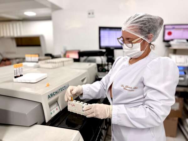 Hospital São José reforça importância da testagem regular para o HIV e outras ISTs