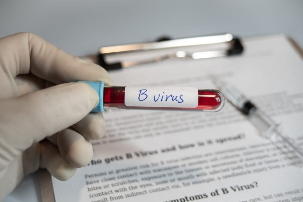 Estudo sugere ligação entre Alzheimer e vírus do herpes