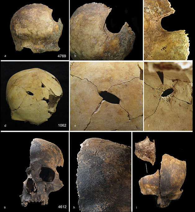 Ossos de 4 mil anos encontrados em poço na Inglat...