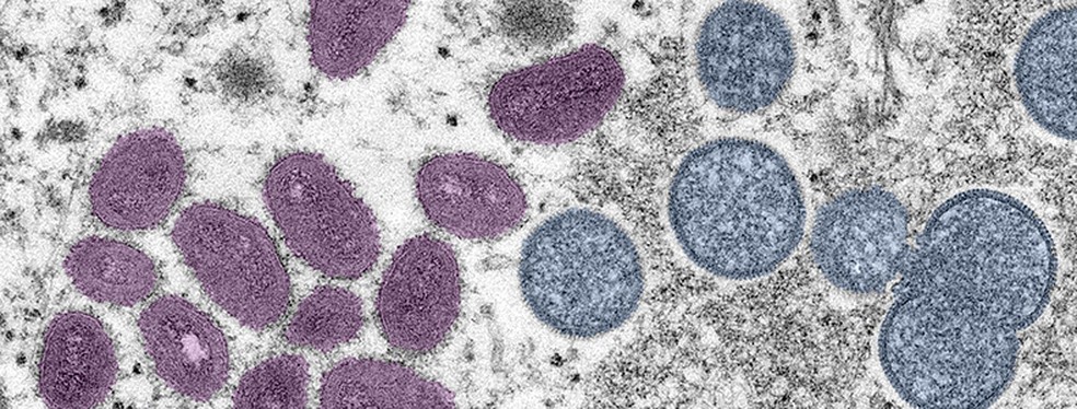 Ministério da Saúde anuncia a compra de mais de 34 mil testes diagnósticos de mpox | Brasil