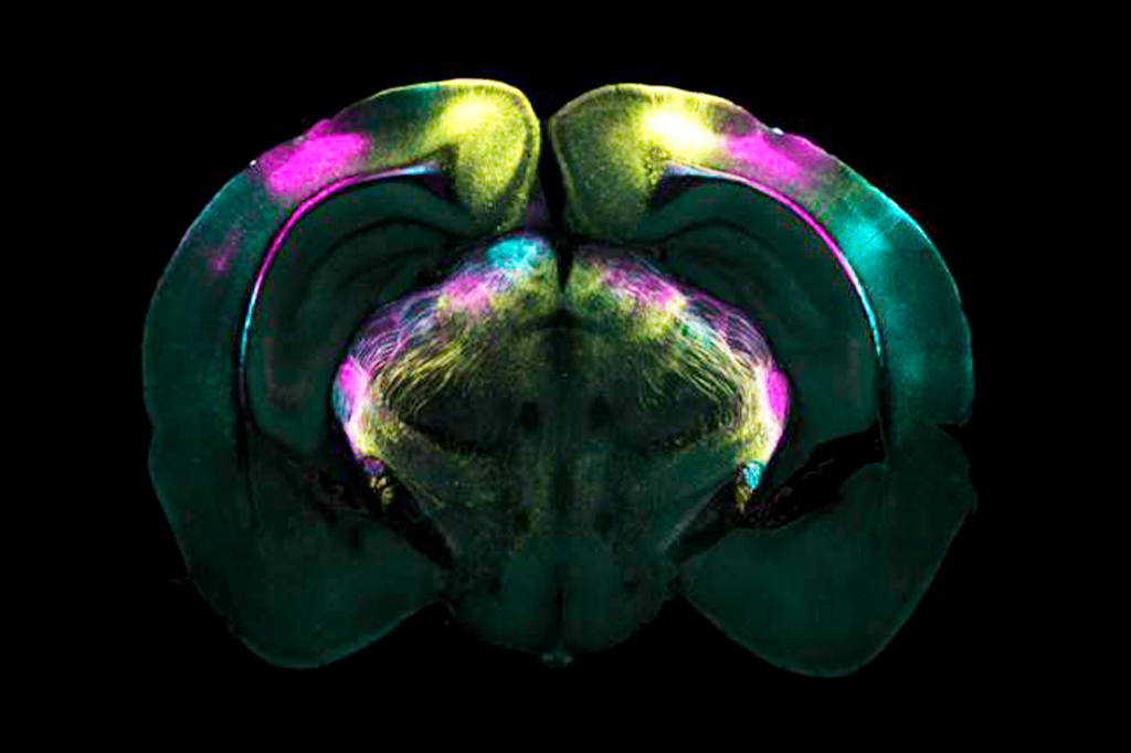Cientistas identificam mecanismo do cérebro que p...