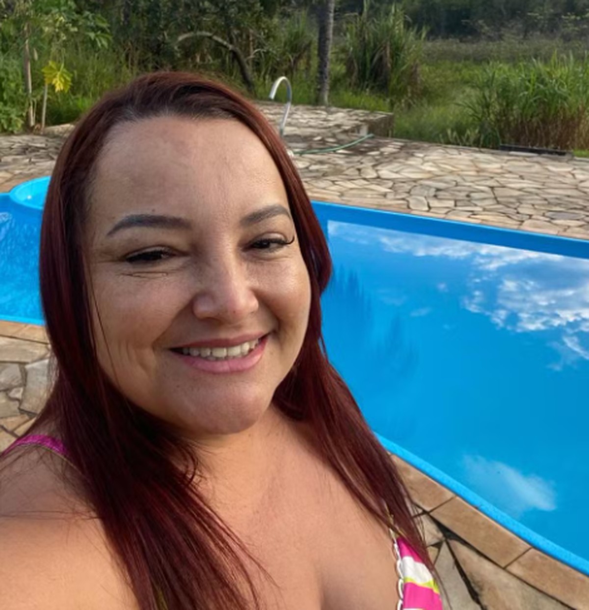 Médico investigado nega perfuração na traqueia de paciente que morreu após procedimento estético em MG | Belo Horizonte