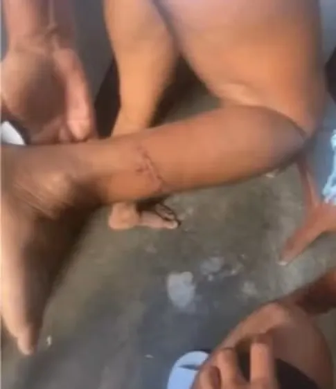 Agressão de Prefeito no Ceará: Mulher Denuncia Violência e Insegurança