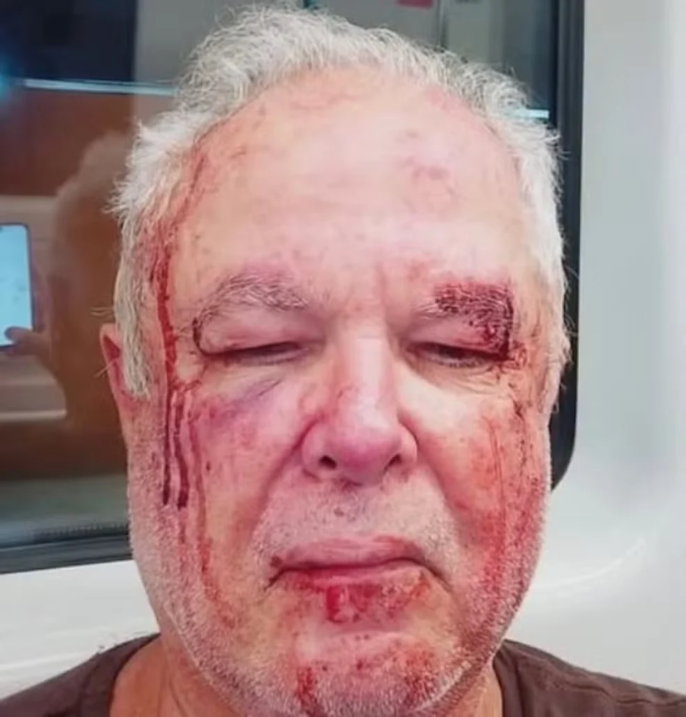 Agressão Política: Idoso de 69 Anos é Agredido em Copacabana por Motivação Política
