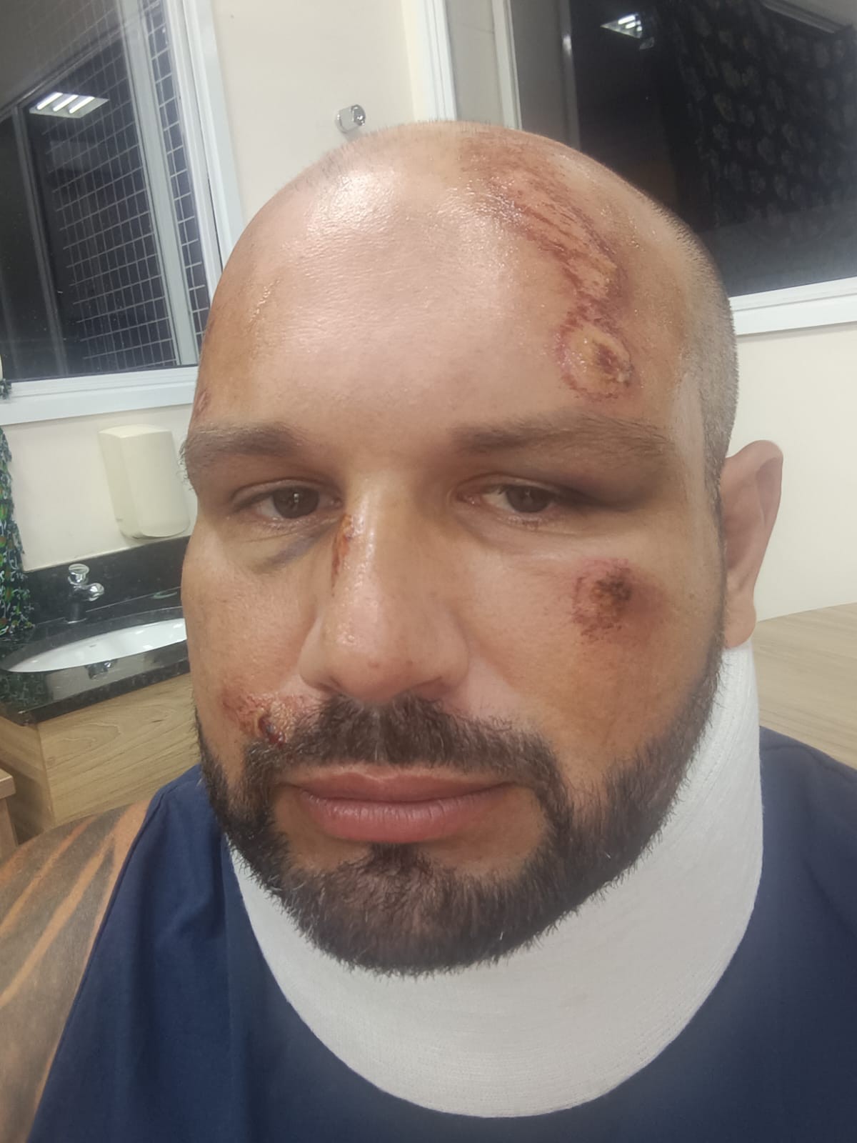 Empresa afirma que passageira acessou 'área proibida' antes de cair de ônibus em movimento