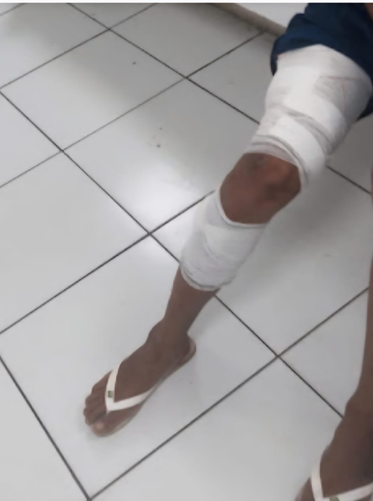 Homem Atingido à Bala em Perseguição Policial em Independência: Conheça os Detalhes