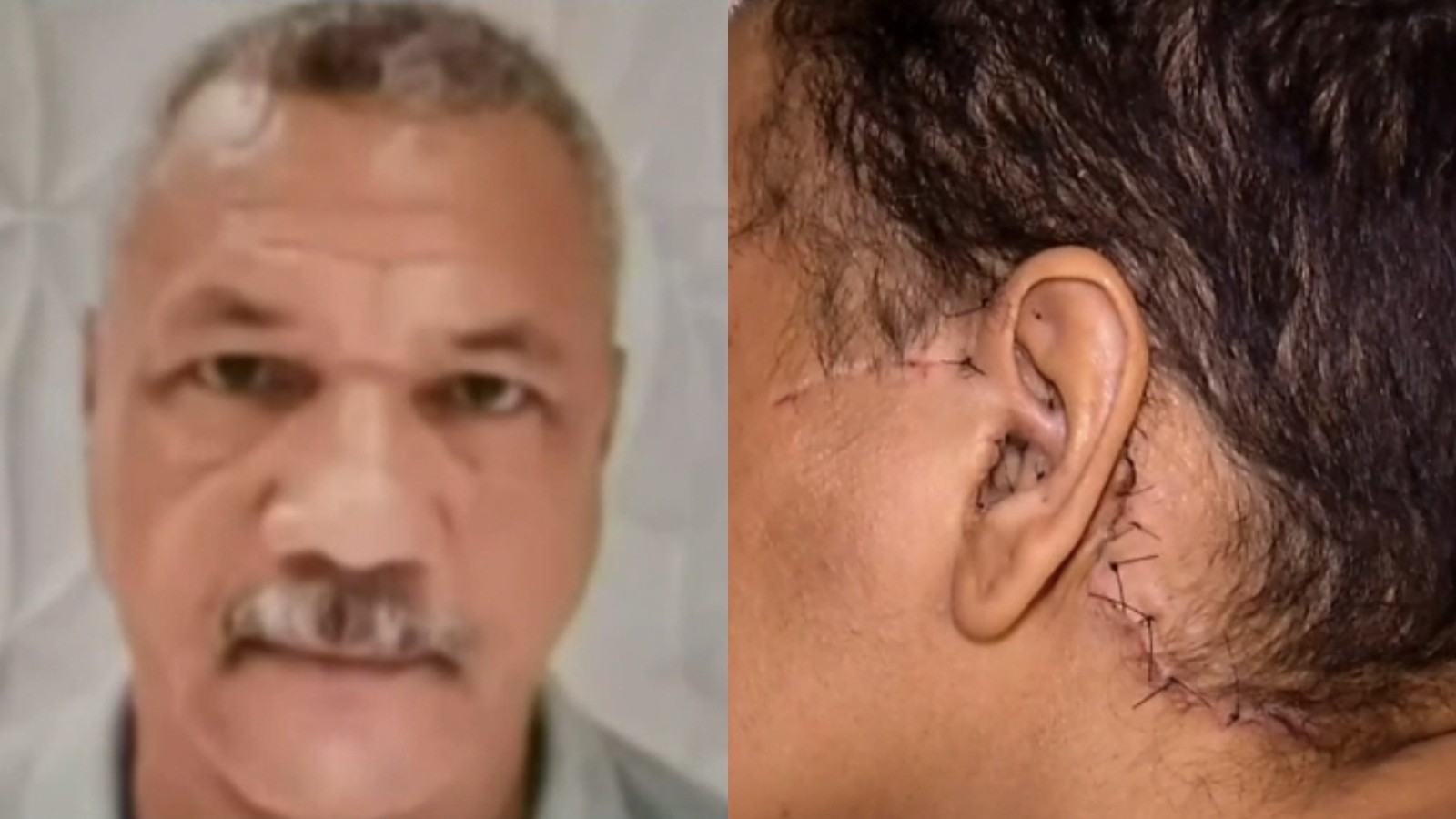 Julgamento de Homem que Esfaqueou Ex-namorada em Fortaleza: O Caso Chocou o País