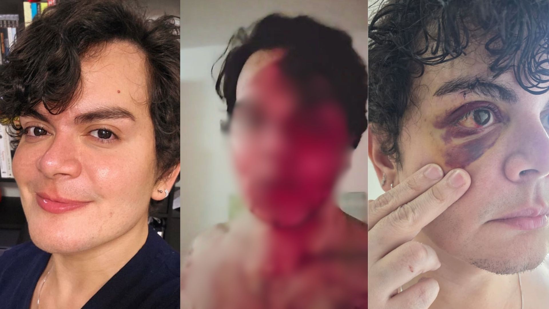 Médico espancado por vizinho após ter apartamento invadido: o que se sabe sobre o caso