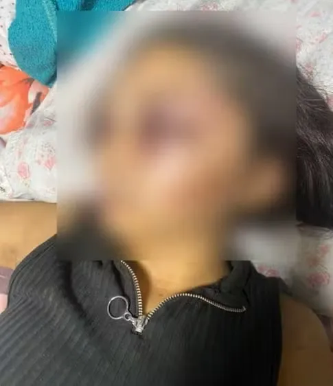 Namorado Suspeito de Agredir Adolescente de 17 Anos é Encontrado Morto no Ceará
