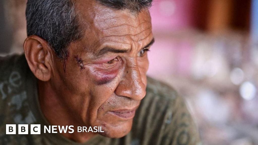 'Nunca pensei que fossem me atacar': os sobreviventes de ataque com míssil durante bombard