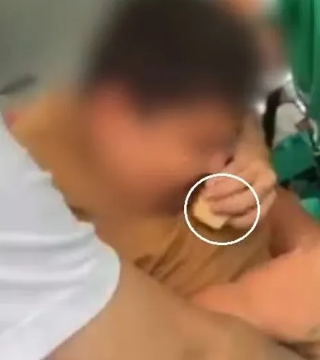 Síndrome de Prader-Willi: Alunos que Forçaram Jovem a Comer Bolo em Fortaleza São Transferidos