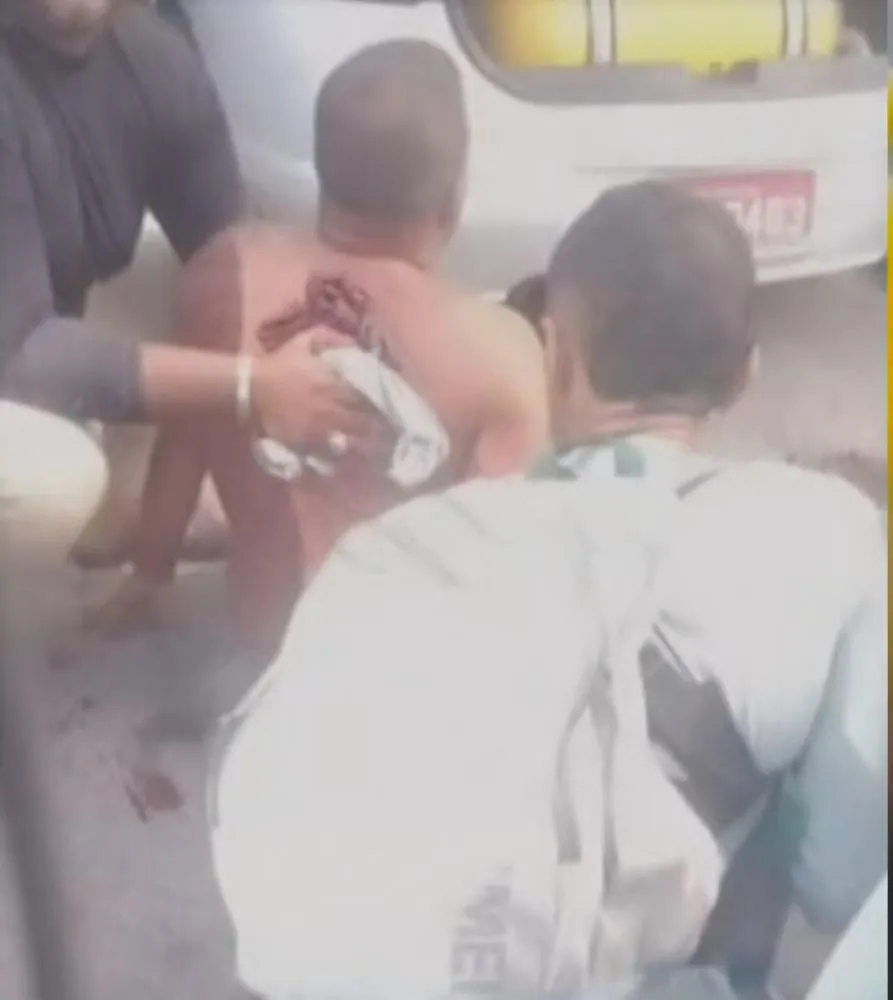 Taxista Ferido em Briga de Faca no Centro de Fortaleza: Polícia Militar Intervém