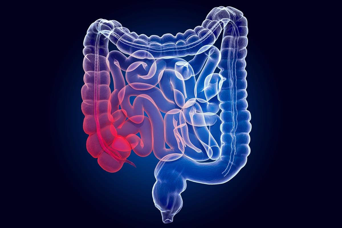 Três frutas saborosas que ajudam a reduzir a inflamação no intestino