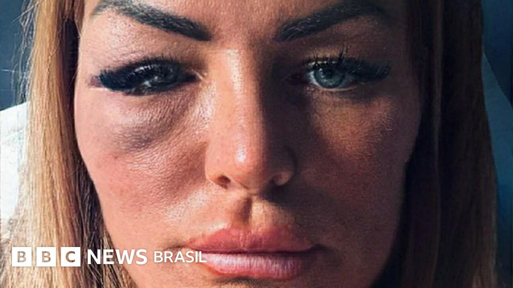 Violência de Gênero: Esteticista é Agredida por Lutador de MMA após Recusar Pedir para Dançar